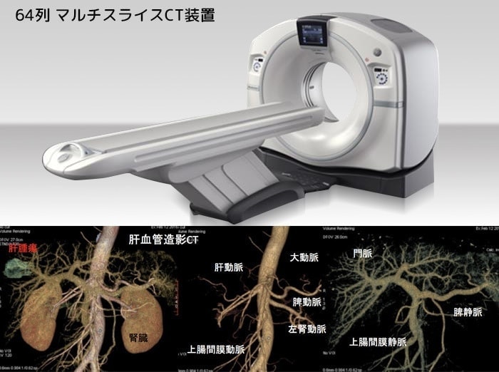 64列マルチスキャンCT装置